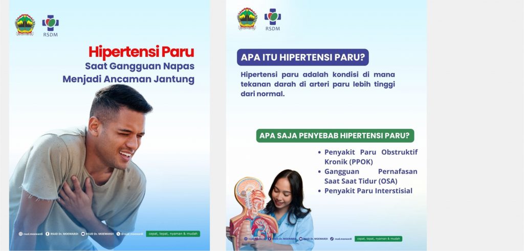 Hipertensi Paru Saat Gangguan Napas Menjadi Ancaman Jantung
