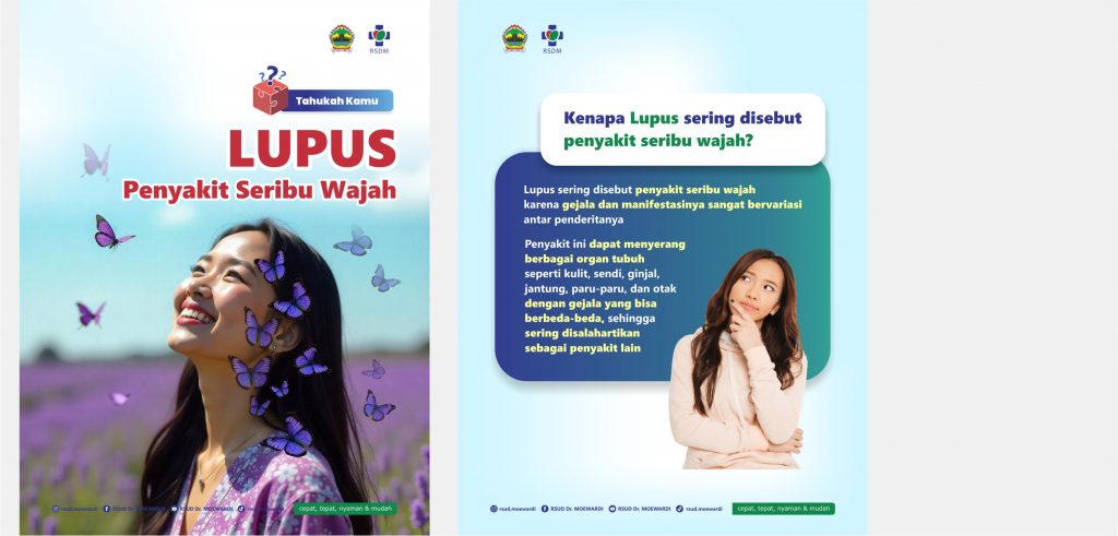 Tahukah Kamu? Lupus Penyakit Seribu Wajah