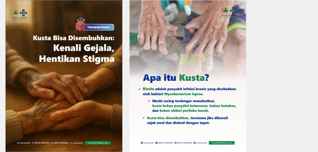 Tahukah Kamu? Kusta Bisa Disembuhkan: Kenali Gejala, Hentikan Stigma