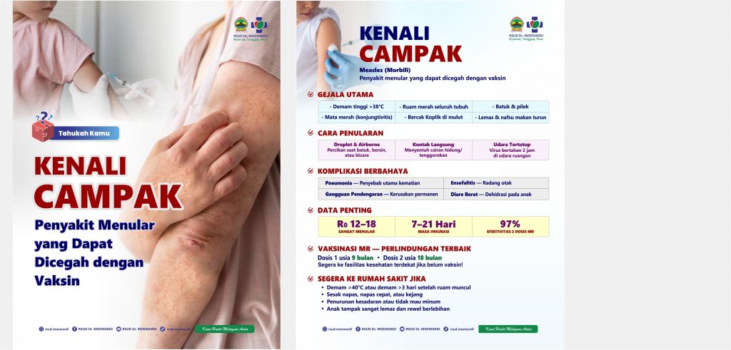 Tahukah Kamu? Kenali Campak, Penyakit Menular yang Dapat Dicegah dengan Vaksin