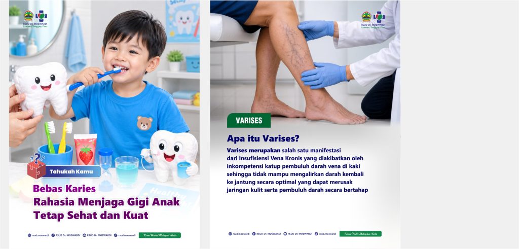 Tahukah Kamu? Bebas Karies Rahasia Menjaga Gigi Anak Tetap Sehat dan Kuat