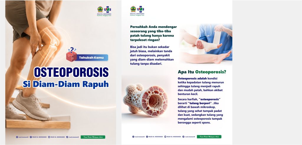 Tahukah Kamu? OSTEOPOROSIS Si Diam-Diam Rapuh